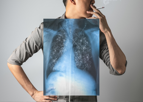 man smoking with xray overlaid on his chest showing swirling smoke in his lungs.