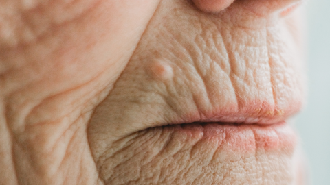 close up of a woman's face with lines above lips