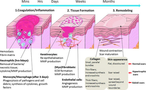 ScarAway® 100% Advanced Scar Gel