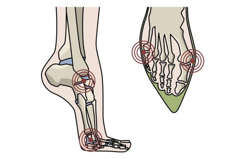 illustration of the musculo-skeletal system on a foot wearing high heels