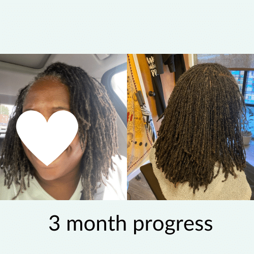loc bundle before and after