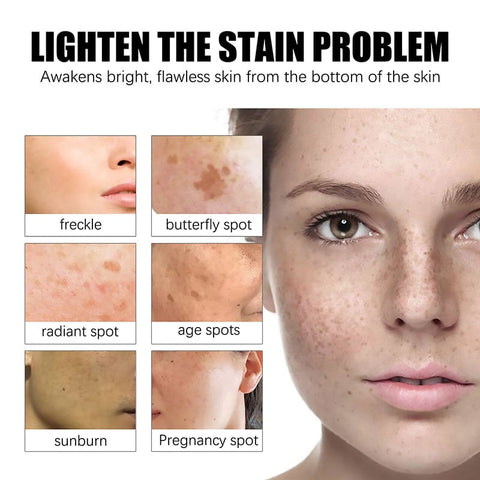 Faues™ Skin Brightening Anti-Spot Serum