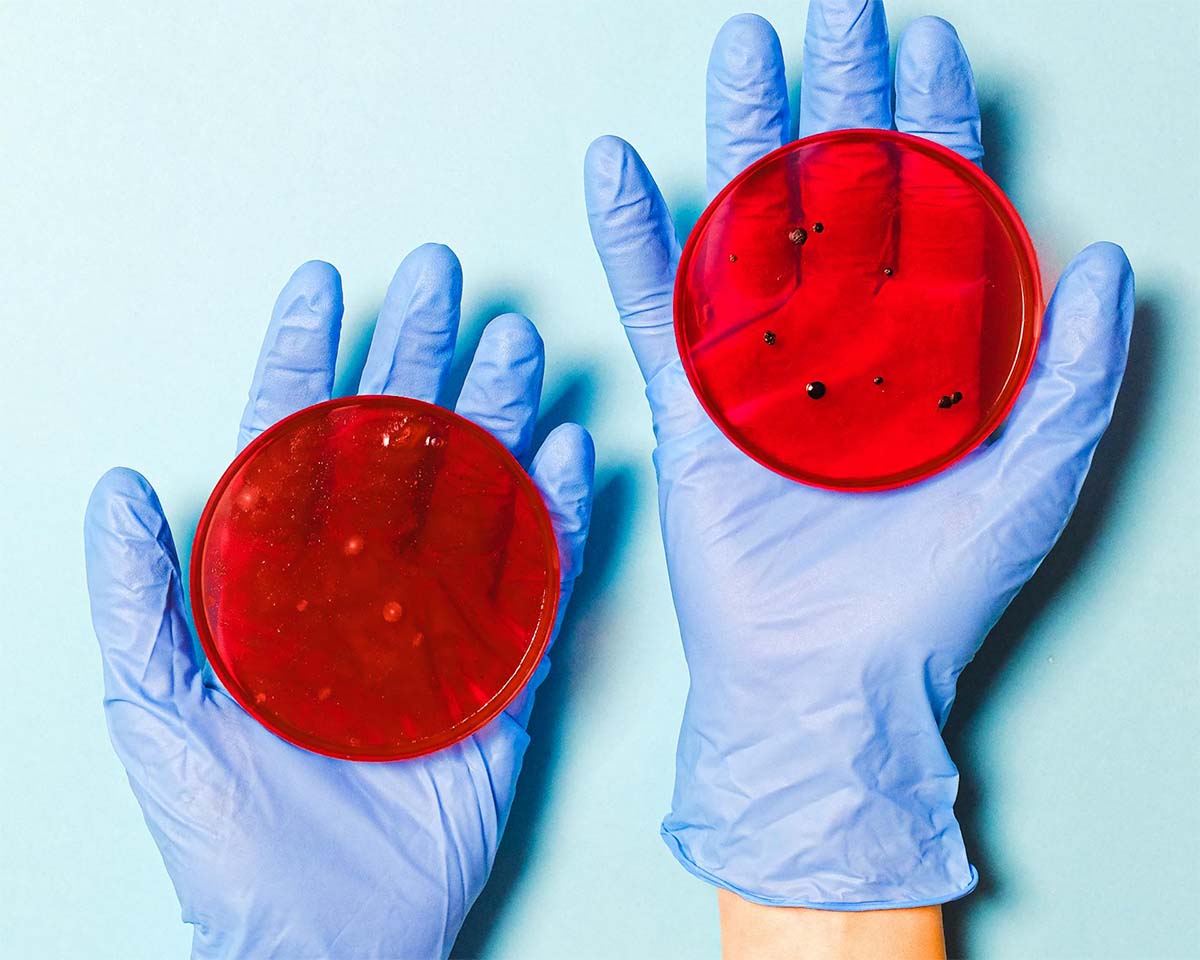 A scientist wearing blue nitrile gloves and holding two petri dishes.