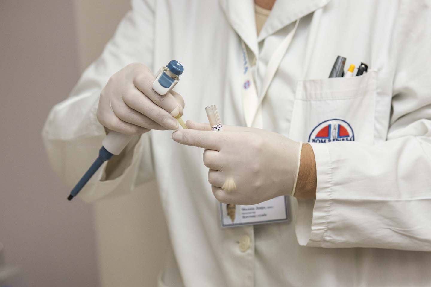 Person in lab coat holds medical equipment in hand while wearing white gloves.