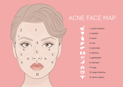 acne face mapping 