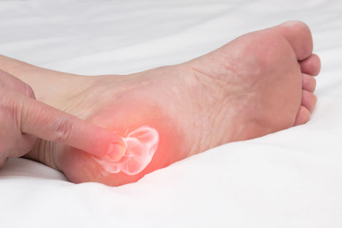 verapamil for plantar fasciitis