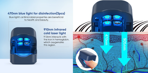 Fivfivgo™ Revolutionary High-Efficiency Light Therapy Device For Toenail Diseases