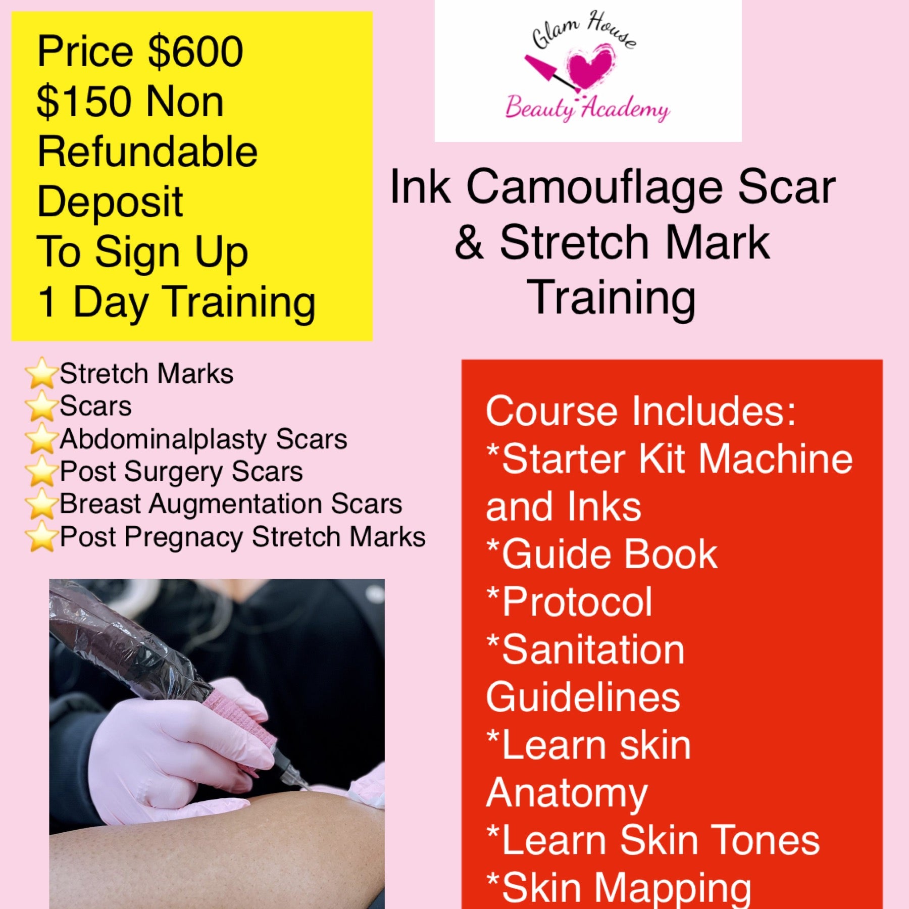 stretch mark tattoo camouflage course