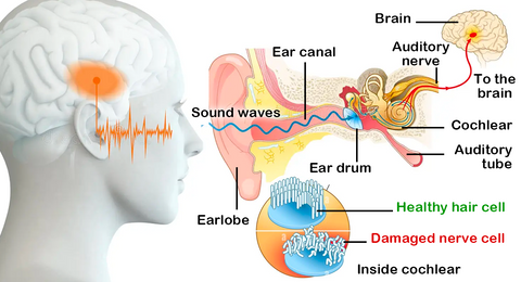 LunaLoom™ AuriCalm Tinnitus Relief Device