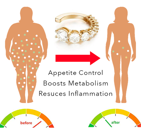 GlamSlim الأذنية صفعة الأذن الكفة