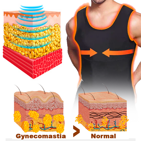 AlphaSculpt™ Gynecomastia Compression Zip-Up Vest