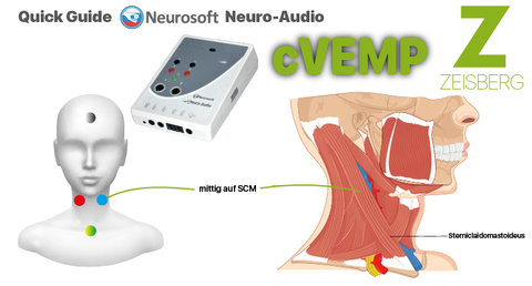 Quick-Guide Neuro-Audio cVEMP