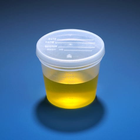 Globe Scientific Container: Tite-Rite, 120ml (4oz), PP, Sterile, Attached Natural Screw Cap, ID Label with Tab Seal, Graduated