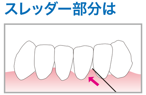 スレッダー