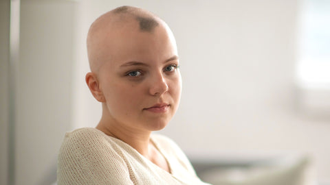 Alopecia Areata