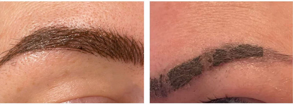 Microblading - Oozing and Scabbing