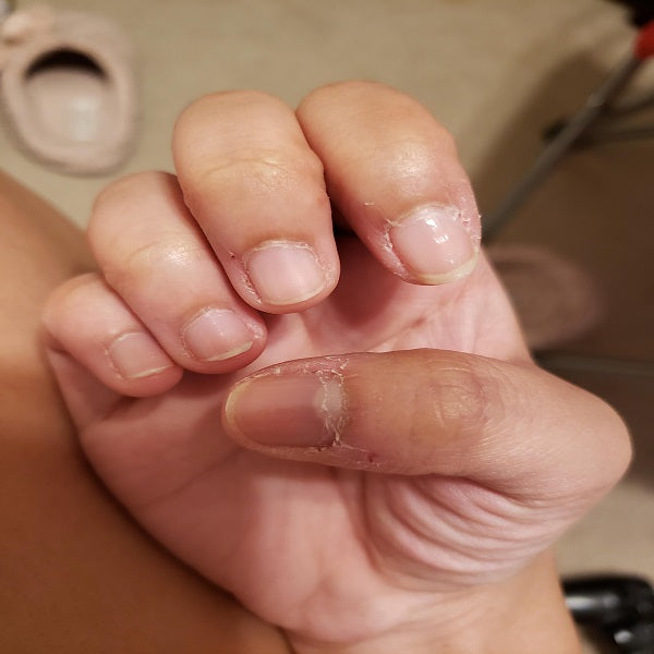 Cuticles are dry