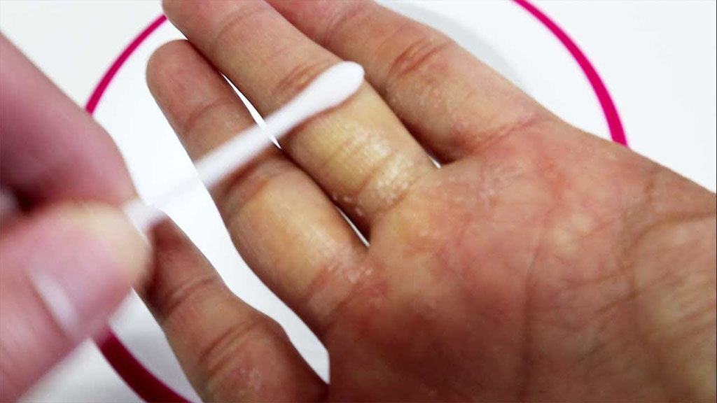 How to Get the Nail Glue off Your Skin?