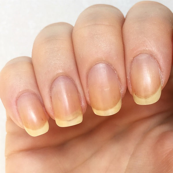 Nails are Yellow