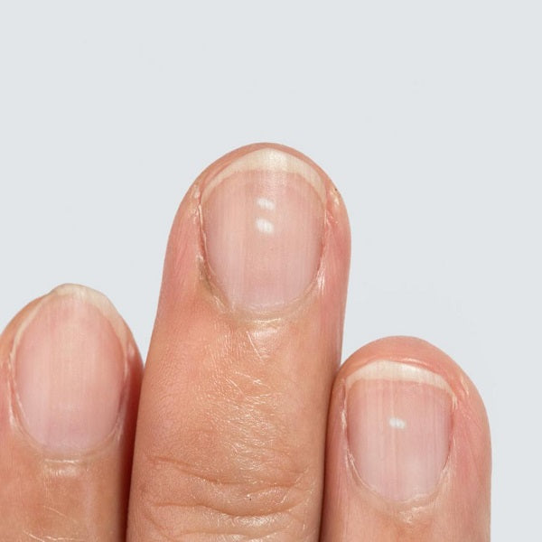 Nails are stained with White Spots