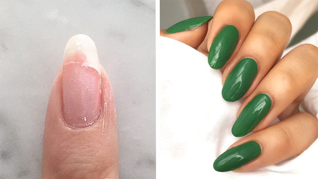 Use fake nails for nail repair