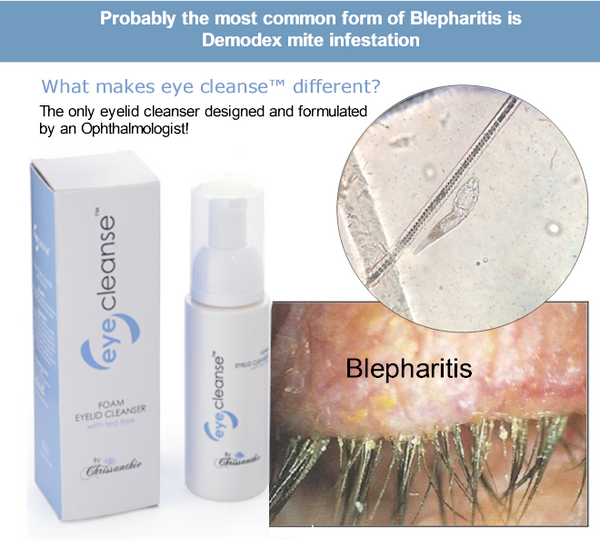 foam cleanser eyelid blepharitis aftercare retail