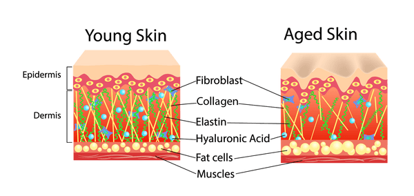 hyaluronic vs collagen, image of aged skin compared to young skin
