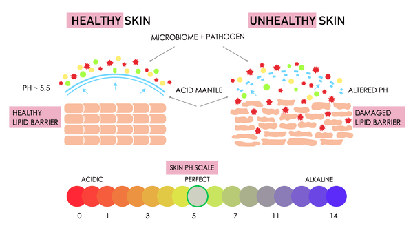 Stock image comparing healthy and broken skin barriers