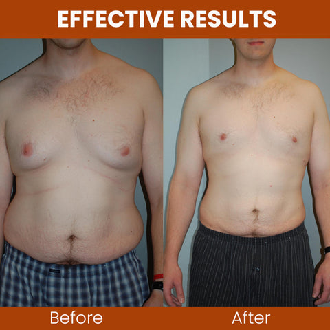 Gynecomastia Chest Tightening Spray