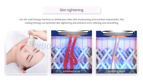 Skin Tightening Treatments