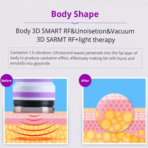 Unoisetion Cavitation Machine Smart RF and Vacuum Improves Body Shape