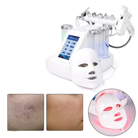 Piel en la cara antes y después del tratamiento con la máquina Hydrafacial