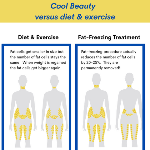 Weight Loss from Diet and Exercise Versus Cryolipolysis, Reduction of Fat Cells in the Body