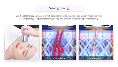 Skin Tightening, Unoisetion Cold Therapy Hanmmer Handle is applied to the face