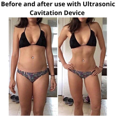 Before and after using conductive gel for body slimming and cavitation machine