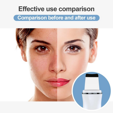 Antes y después del uso del exfoliante de piel ultrasónico