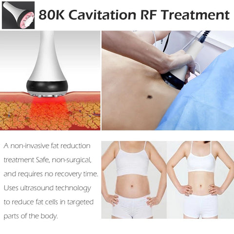 80k Cavitation Treatment, Probe is Applied to Skin, Body Shape Before and After