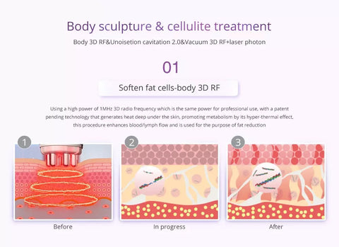 Body Sculpture and Cellulite Treatment of Unoisetion Cavitation 2.0