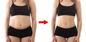 Woman’s body before and after treatment with  S-Shape Cavitation Machine