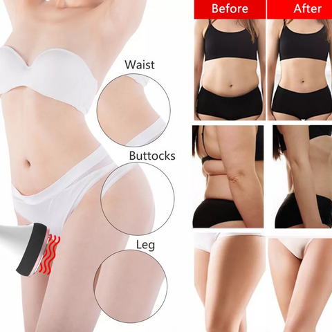 40k Cavitation Machine Slimming effects on Waist Buttocks and Legs