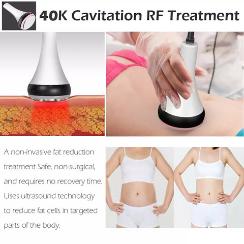 40k Cavitation Probe and radio frequency probes, body slimming before & after