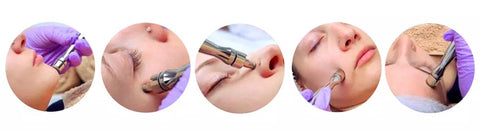 Diamond Microdermabrasion Machine Tips are Used on Face for Treatment