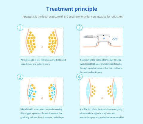 Treatment Principles of Cryotherapy Fat Freezing