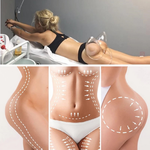 Usage of Vacuum Therapy Machine on Buttocks