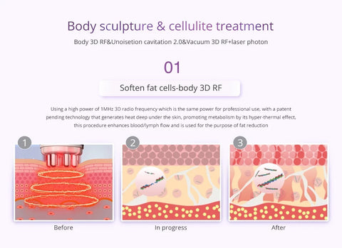 Tratamiento de Escultura Corporal y Celulitis de la Máquina de Cavitación