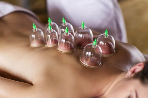 Cuppingmassage, wat is het? | Lees het op intertaping.nl