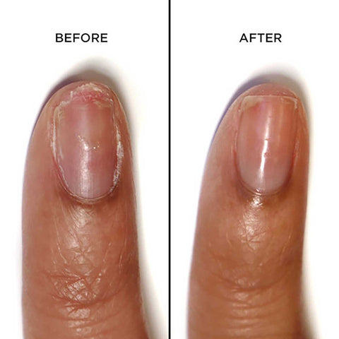 The Proof is in the Pudding… or in the Nail Bed: Check Out Real Before