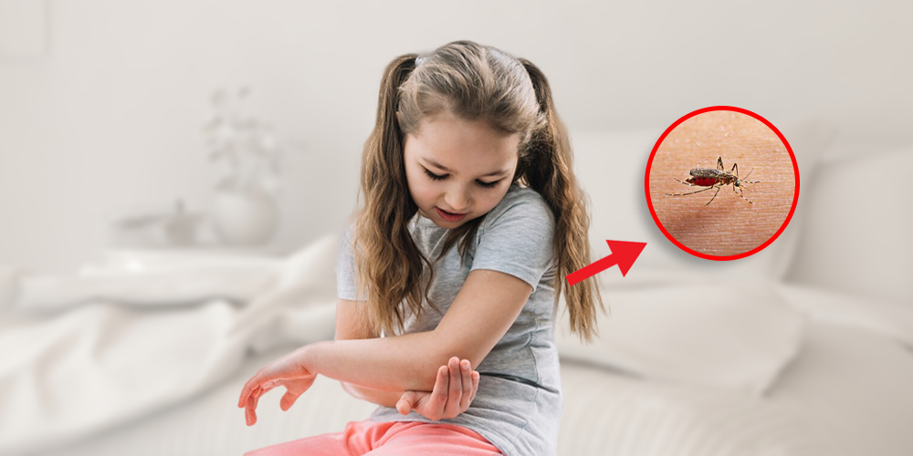 Remedies For Mosquito Bites In children