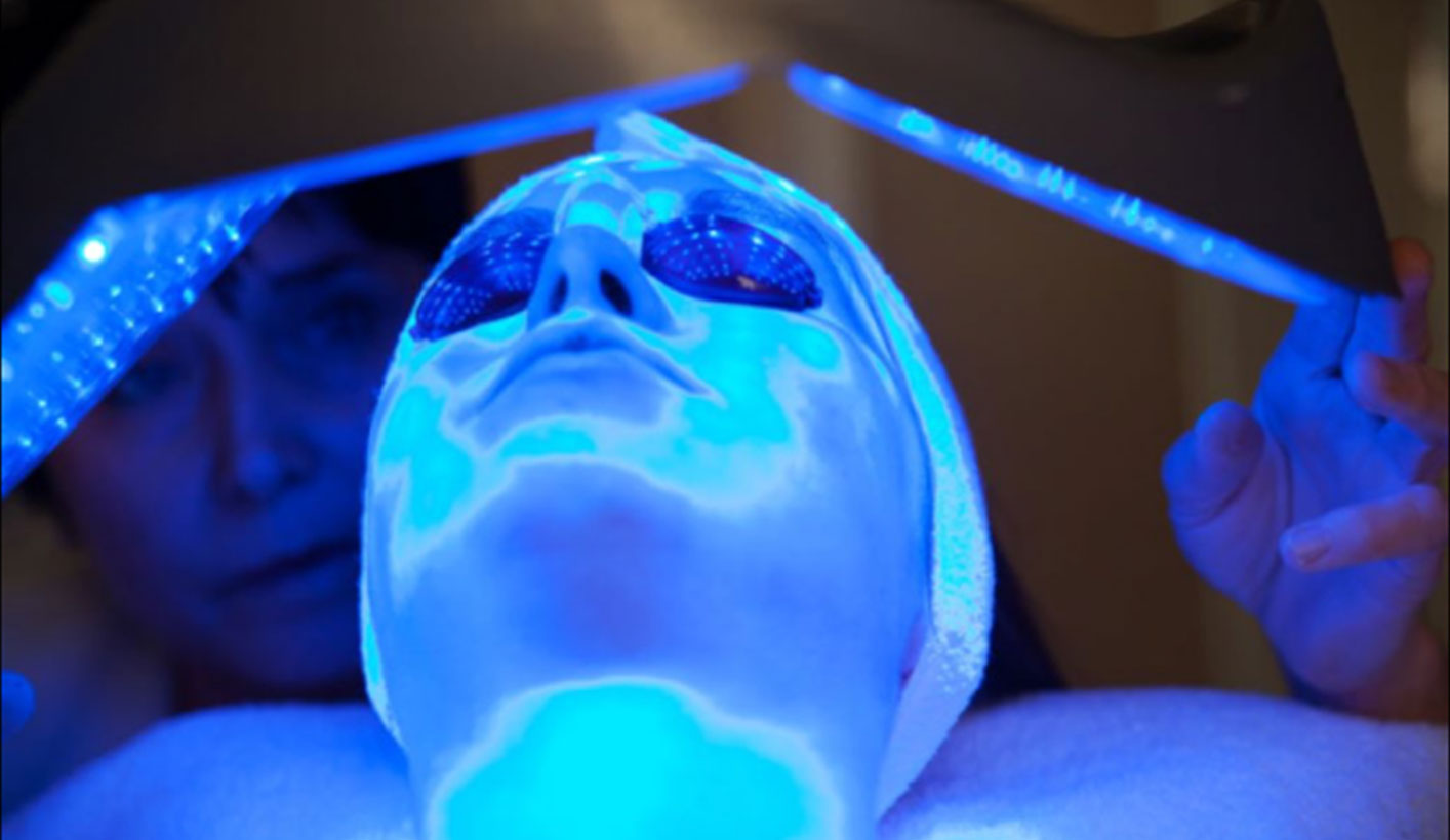 Blue light therapy to treat acne