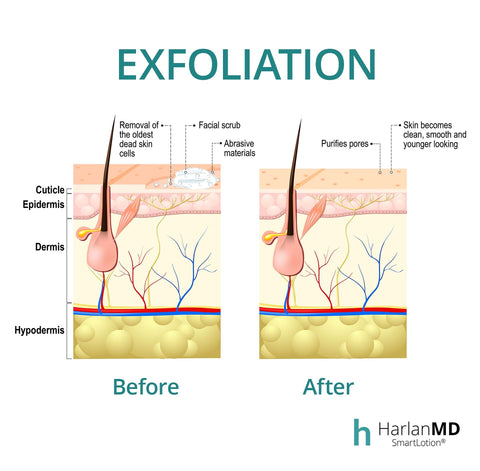 a graphic presenting what exfoliation is